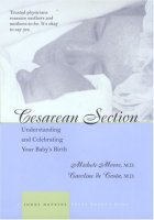 image of Caesarean Section, Understanding and Celebrating Your Baby's Birth